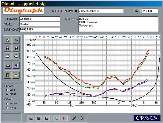 OTOSOFT software